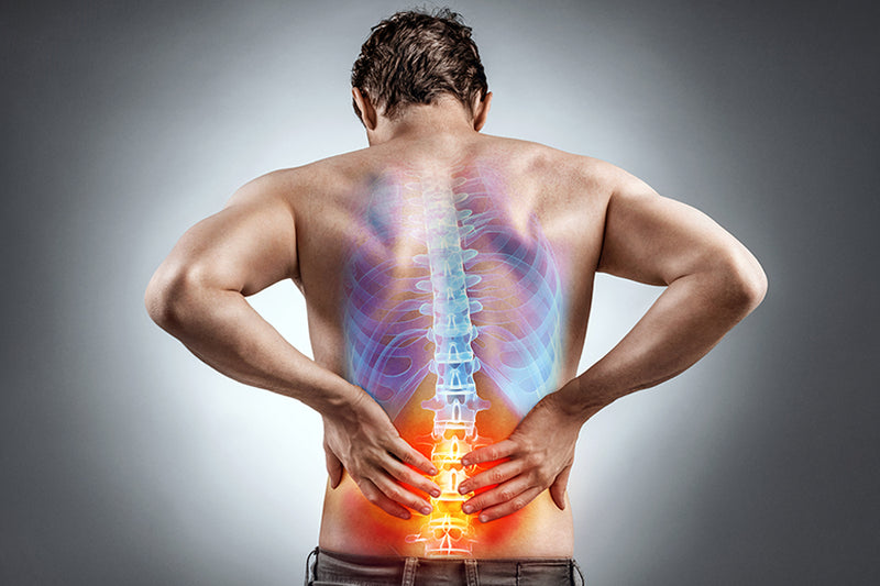 What is Sciatica & What Exercises Can Help Reduce Sciatic Nerve Pain?