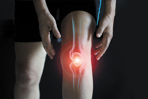 Knee Sleeves vs Knee Brace: Differences and Benefits