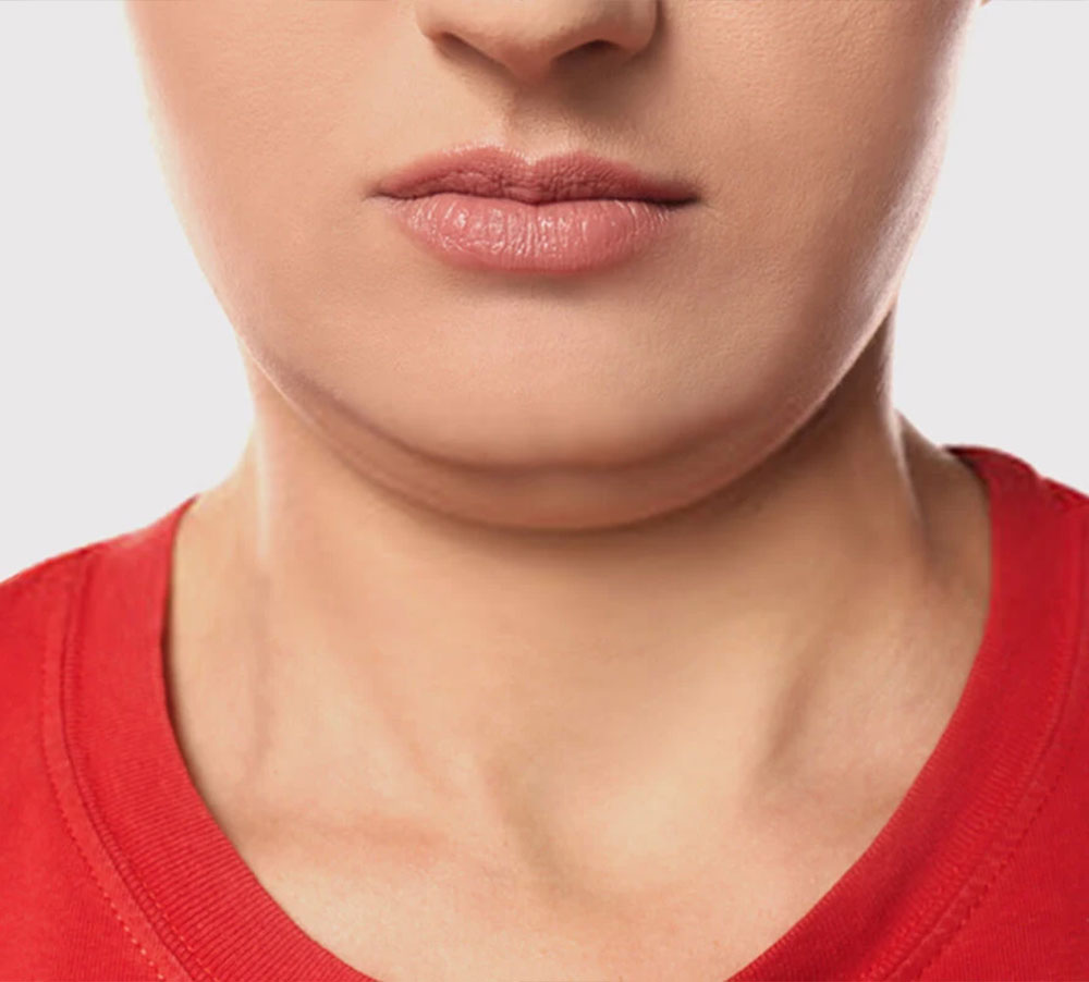 7 Quick And Easy Neck Exercises That Can Help You Completely Get Rid Of The Double Chin You Hate