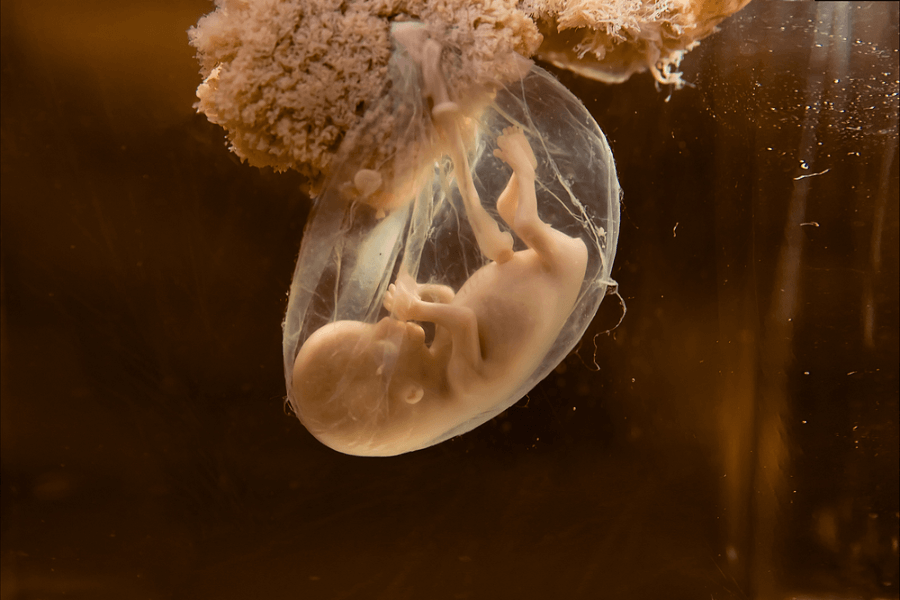 Rat Study Sparks Concerns: Could Tiny Plastic Particles Reach the Unborn?