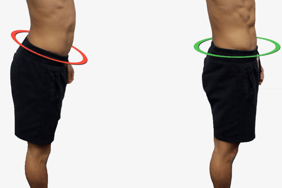 What is Anterior Pelvic Tilt? Causes, Symptoms, and How to Fix It