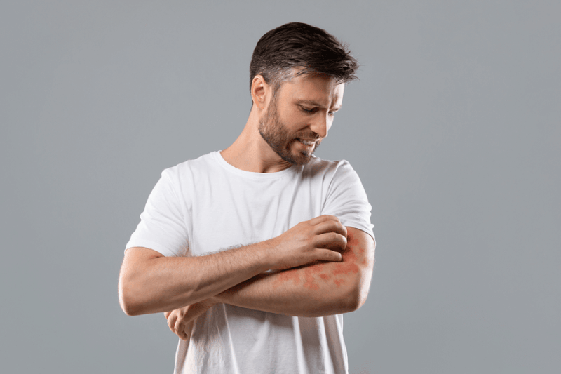 Living Near A Noisy Highway May Increase the Risk Of Developing Eczema!