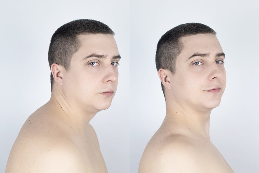 How to Get Rid of Neck Hump Fast